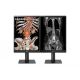 LG 21.3'' 3MP IPS Diagnostic Monitor – 2