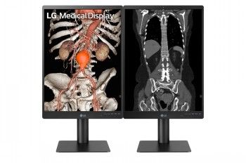 LG 21.3'' 3MP IPS Diagnostic Monitor – 2
